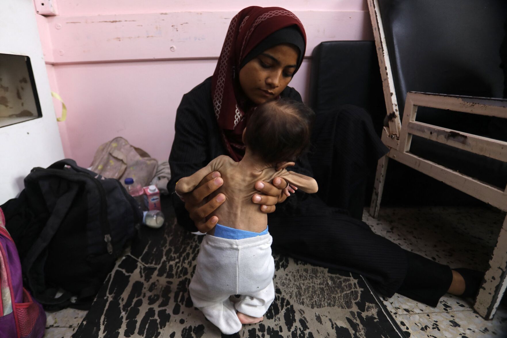 Starving-child-gaza(3).JPG